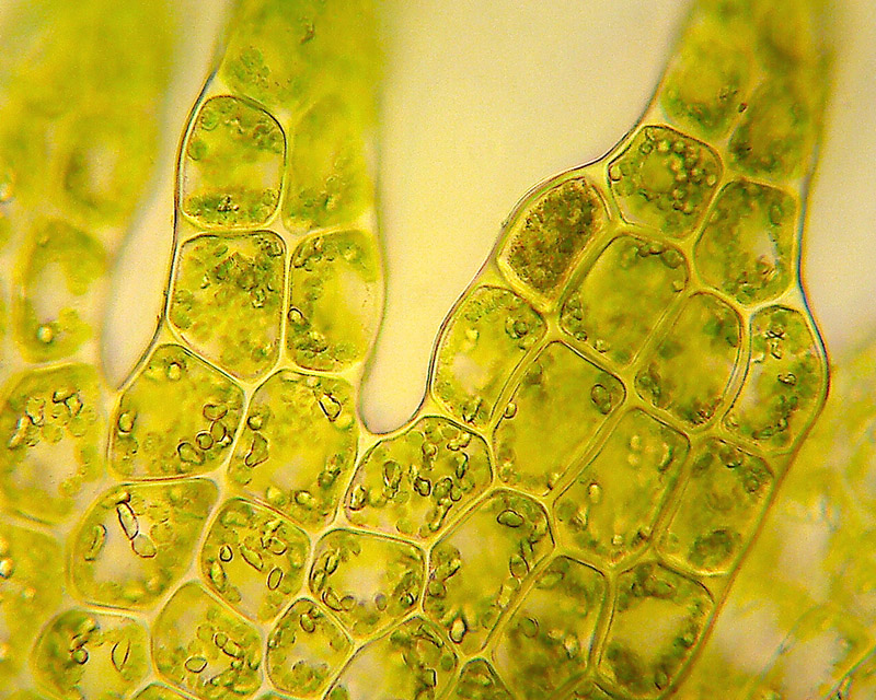 Lepidozia reptans, cellules de l'apex d'une feuille